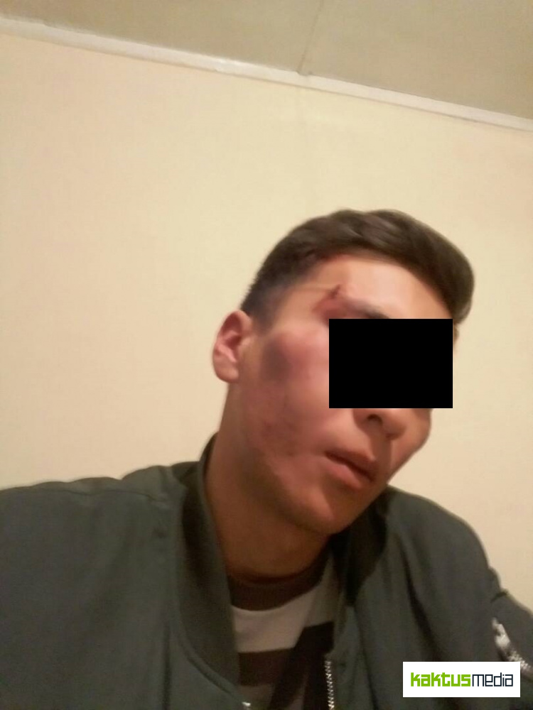 В Бишкеке таксист с друзьями напал на клиента. А милиция их отпустила