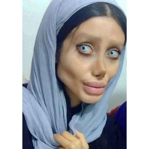 Иранка сделала 50 операций, чтобы выглядеть как Анджелина Джоли (фото)