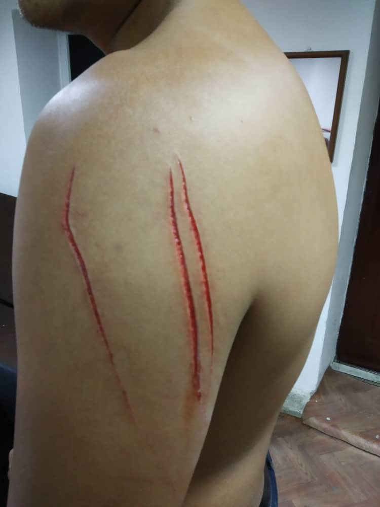 Бишкекский милиционер получил ножевое ранение во время задержания  подозреваемых (фото)