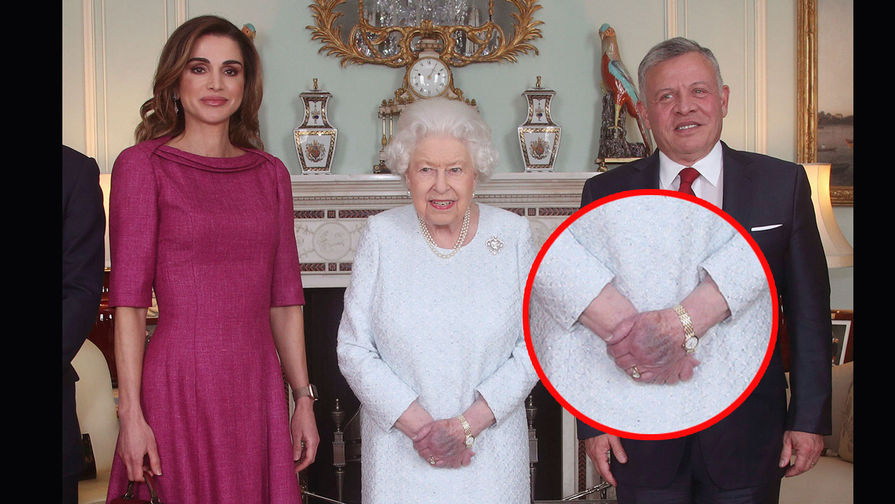 Королева Елизавета II вышла на публику с огромным синяком на руке (видео)