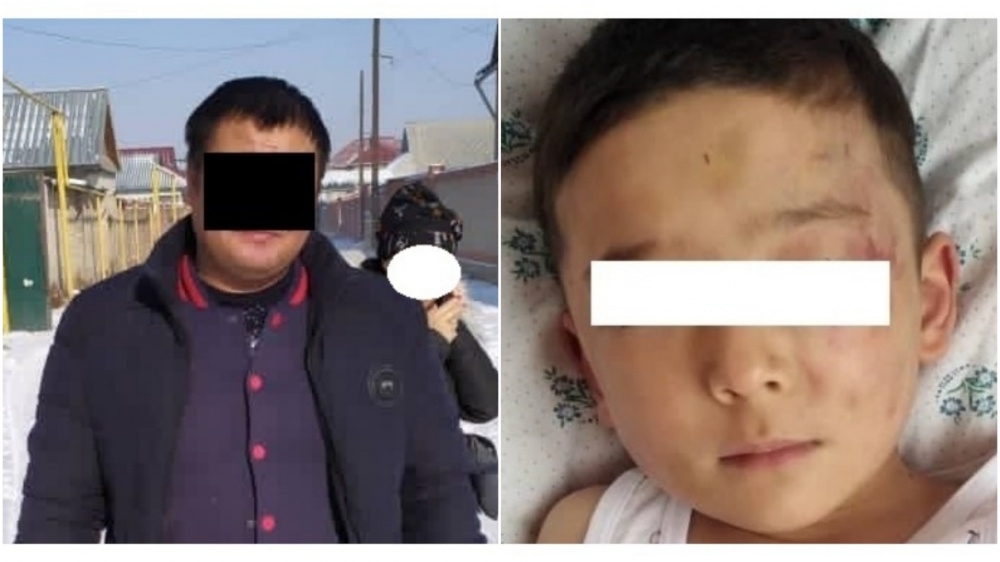Избиение шестилетнего ребенка отчимом. Глава МВД взял дело на контроль