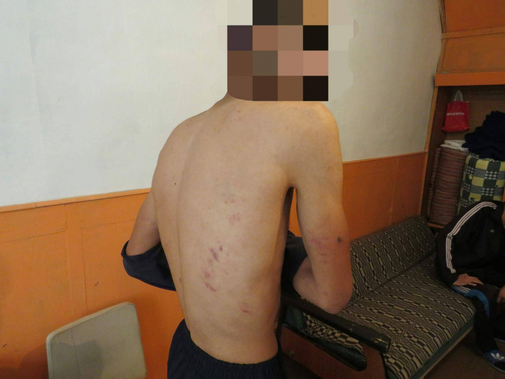 НЦПП о пытках: Запрещенные методы дознания стали применять на нейтральной территории