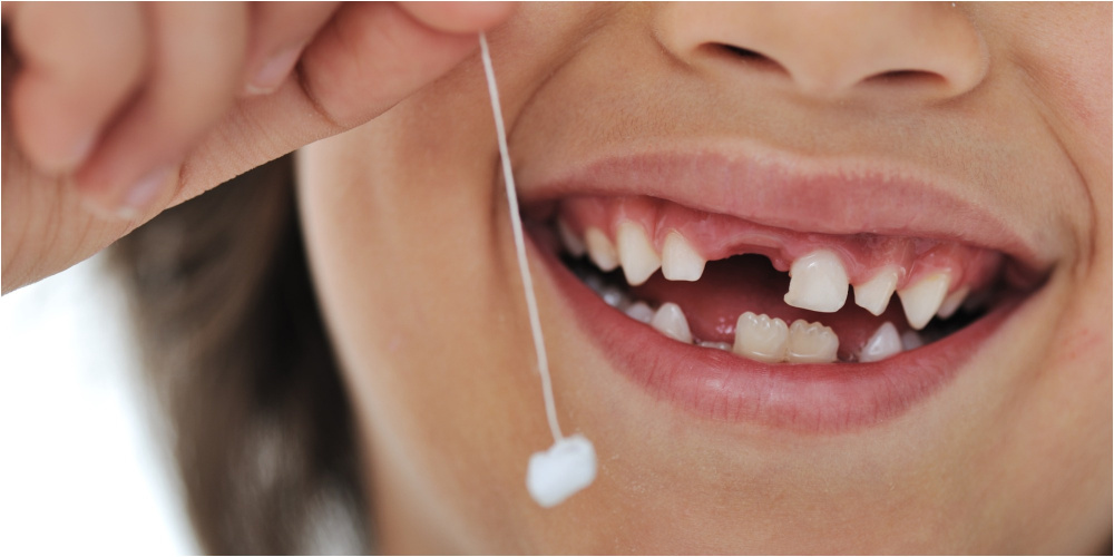 Стоматолог пояснил, какой зуб родители путают с молочным и почему делать этого не стоит