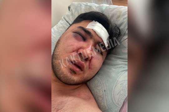 В Бишкеке избили актера, а милиция и прокуратура отпустили подозреваемых (видео)