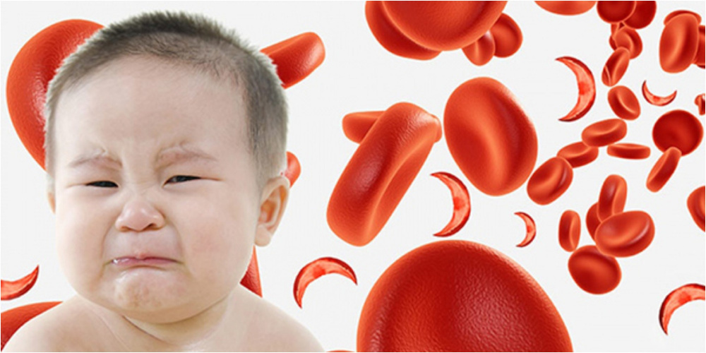 Дефицит железа у детей. Что важно знать родителям