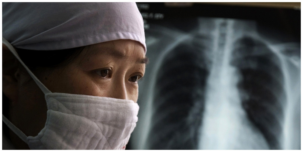 Кто дисциплинированнее лечится от туберкулеза - мужчины или женщины? Ответ ученых