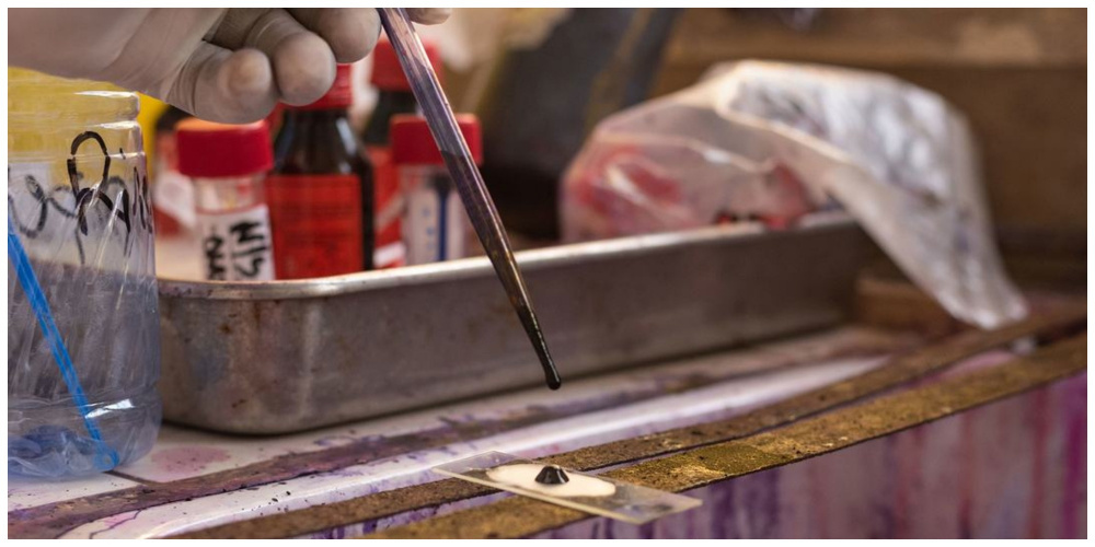 Супербактерии наступают: смертность может превысить рак