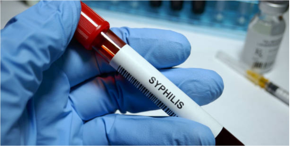 Иногда симптомов нет. Что еще важно знать про сифилис