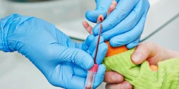 В 2027 году в Кыргызстане проведут новое исследование риска отравления свинцом у детей.