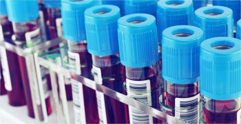 В Кыргызстане готовятся запустить лабораторию для выявления свинца в крови детей.